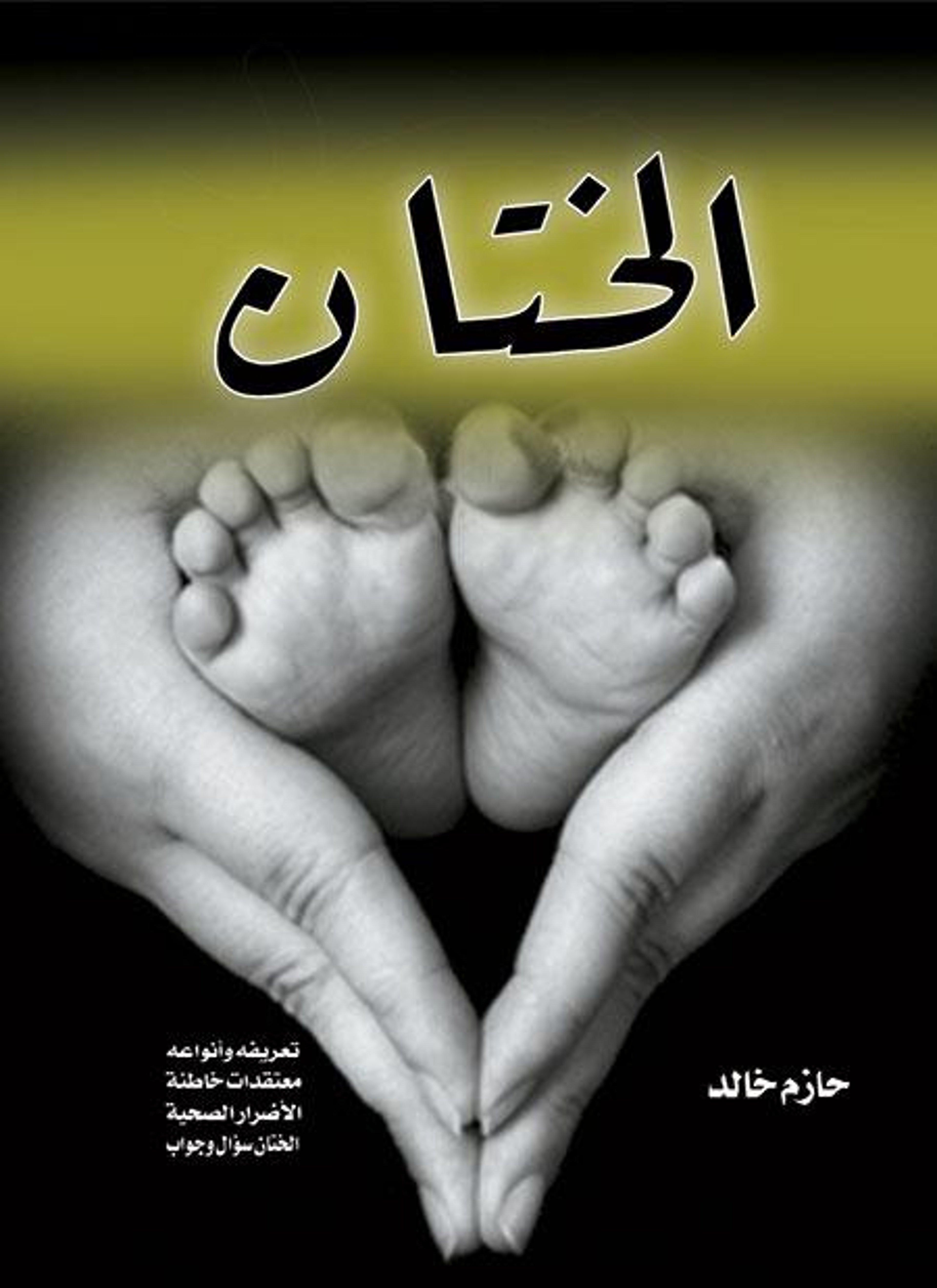 الختان